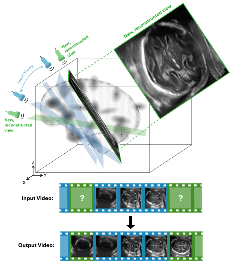 UltraGauss: Ultrafast Gaussian Reconstruction of 3D Ultrasound Volumes