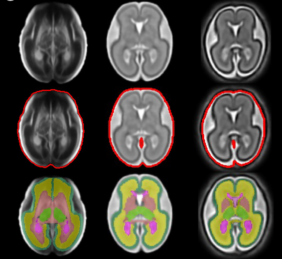 Normative growth trajectories of fetal brain regions validated by satisfactory maturation of neurodevelopmental domains at 2 years of age