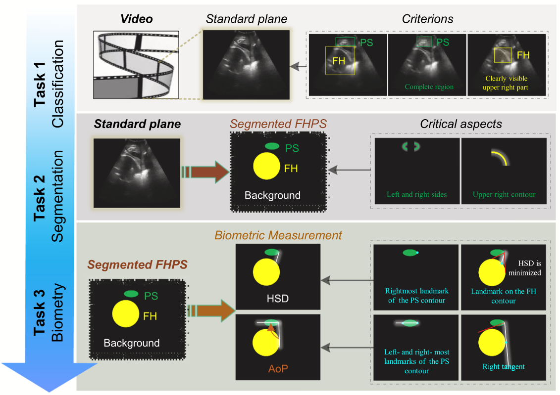 Beyond benchmarks of IUGC: Rethinking requirements of deep learning method for intrapartum ultrasound biometry from fetal ultrasound videos