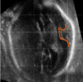 Fully-automated alignment of 3D fetal brain ultrasound to a canonical reference space using multi-task learning