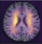 Learning patterns of the ageing brain in MRI using deep convolutional networks