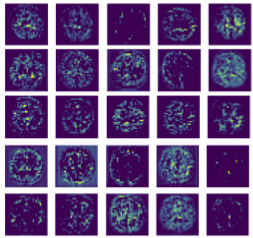 Challenges for machine learning in clinical translation of big data imaging studies