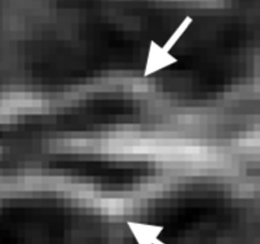 Assessment of Regional Cortical Development Through Fissure Based Gestational Age Estimation in 3D Fetal Ultrasound