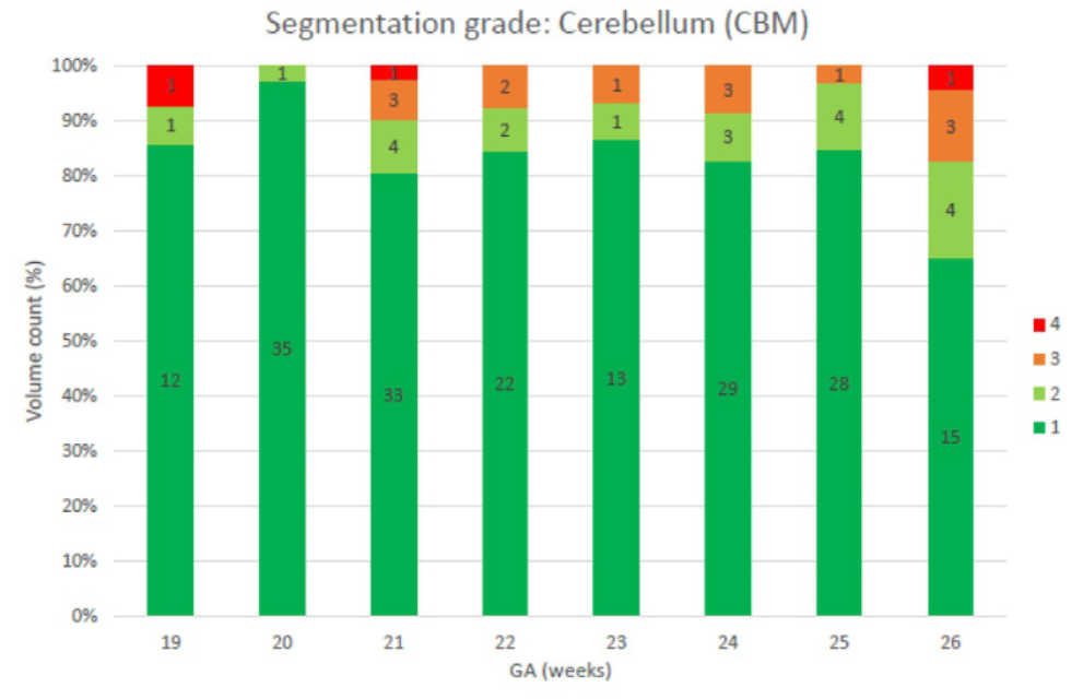 Clinical Grading of Artificial Intelligence Based 3D Fetal Brain Segmentations: A Cross Vendor Evaluation of Deep Learning in Fetal Neuroimaging