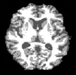 Deep learning-based unlearning of dataset bias for MRI harmonisation and confound removal