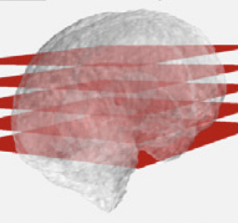 Sensorless volumetric reconstruction of fetal brain freehand ultrasound scans with deep implicit representation