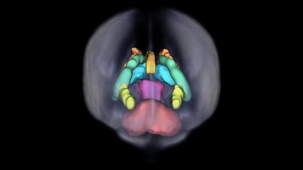Fetal brain structures segmented by the toolkit