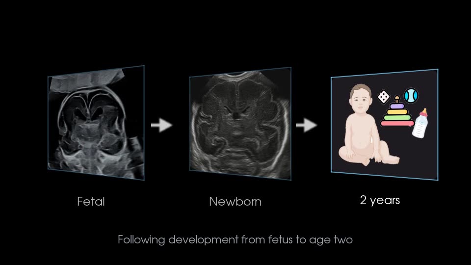 Following development from fetal scan to newborn to 2 years